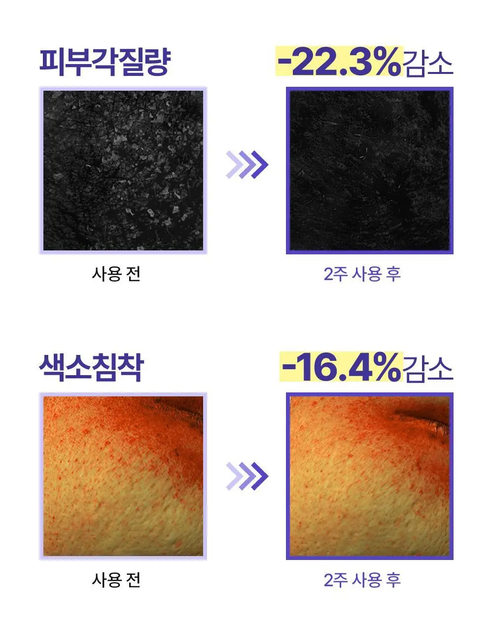 [모공케어] 무슈제이 레티놀로지 데일리 리페어 (로션/에센스) 택 1 상세페이지 24